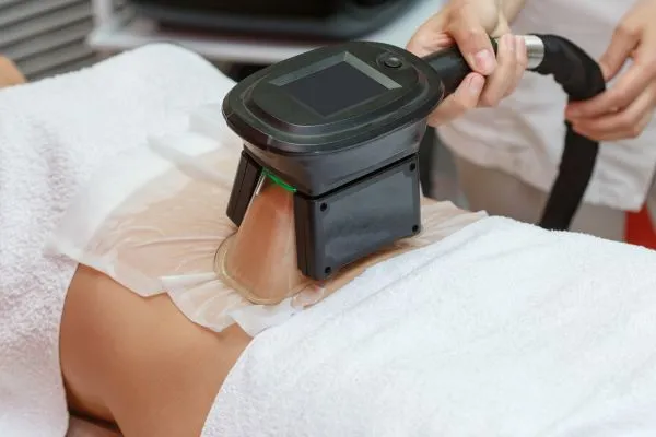 Image of person having fat freezing treatment to help weight gain Sunderland
