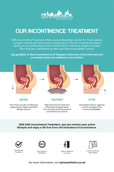 image of how urge incontinence Sunderland treatment works