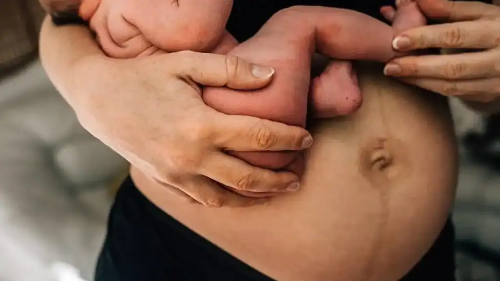 Why Is My Stomach Still Big After Pregnancy Sunderland?